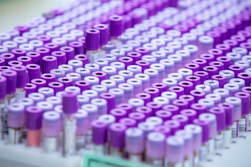 A single pathology service for mid and south Essex is confirmed from October 2026
