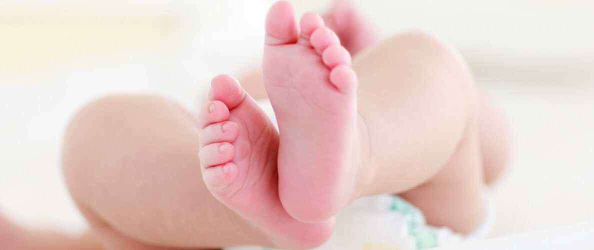 Baby feet - Newborn screening for SMA is done by heel prick testing