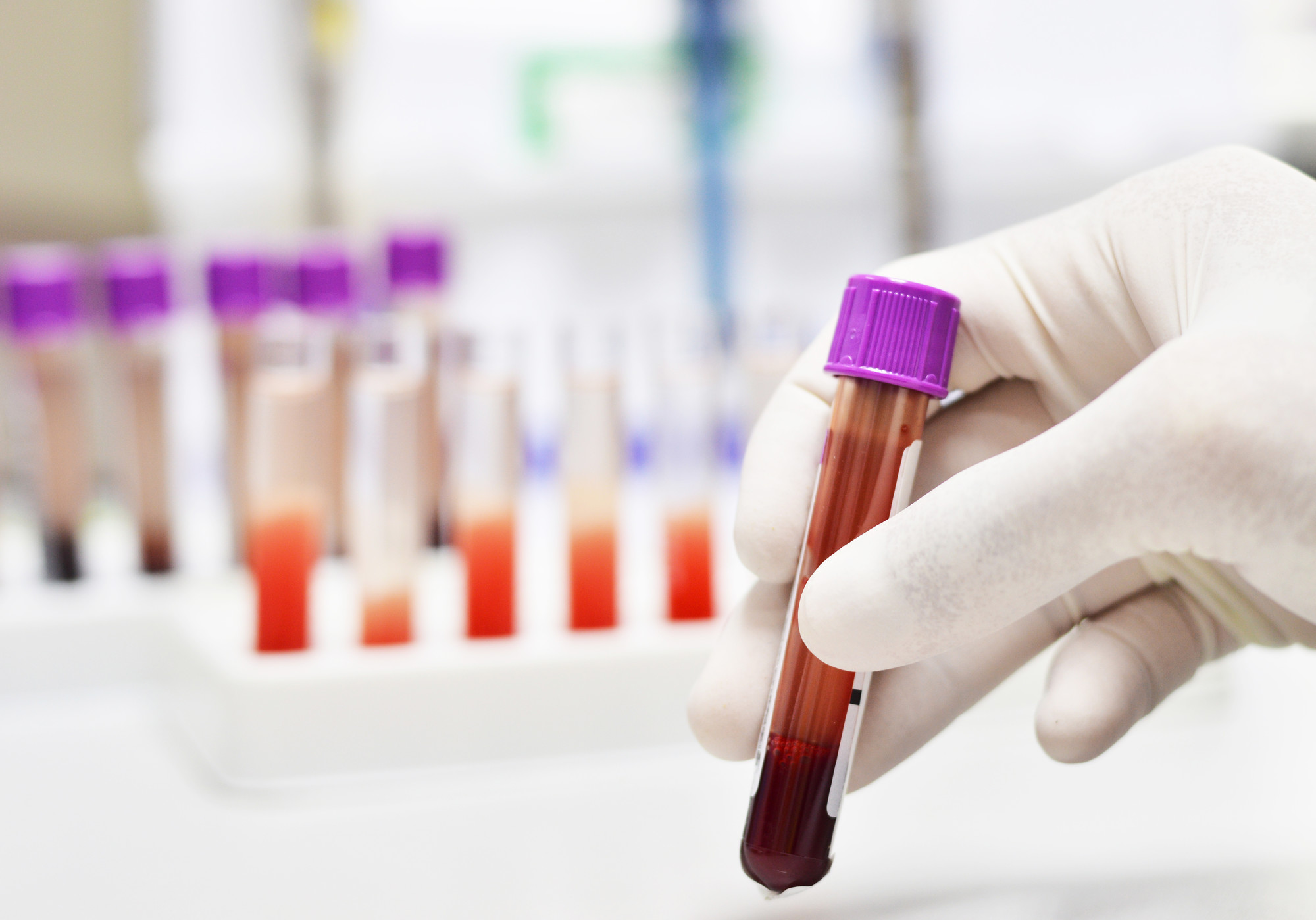 blood sample tube