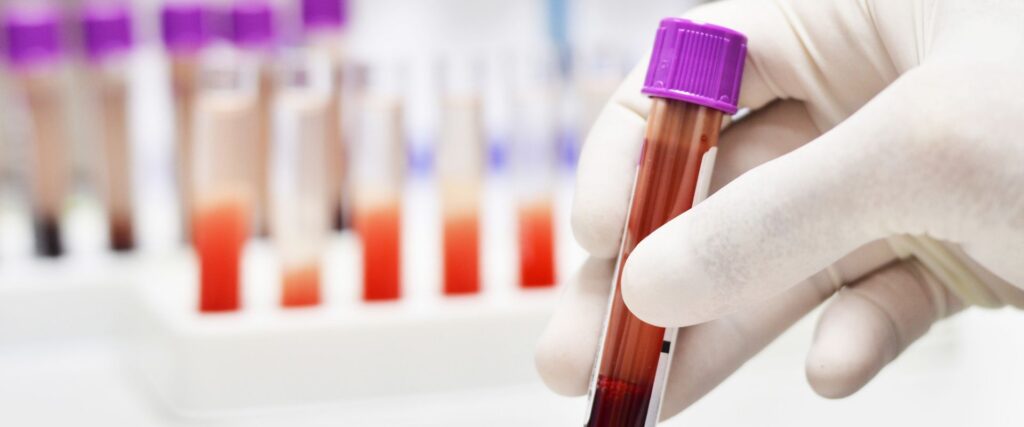 blood sample tube
