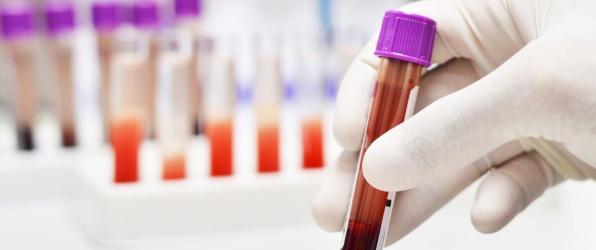 blood sample tube